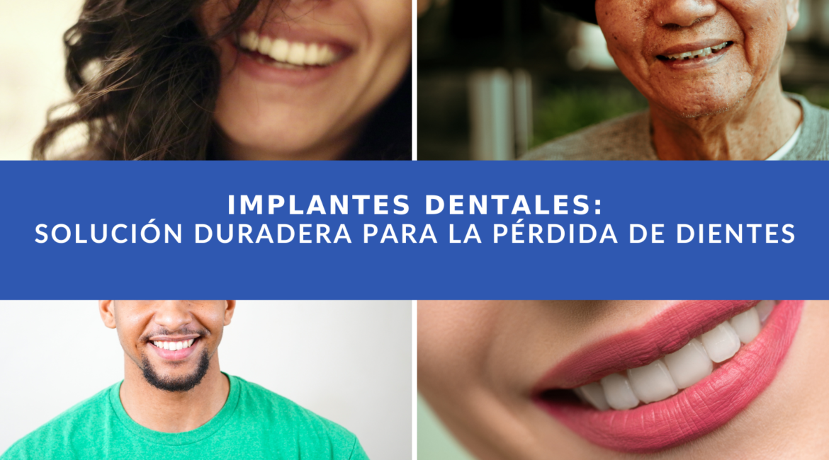 La mejor forma de recuperar un diente es colocarse un implante dental