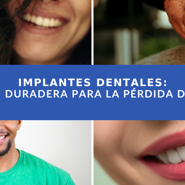 La mejor forma de recuperar un diente es colocarse un implante dental