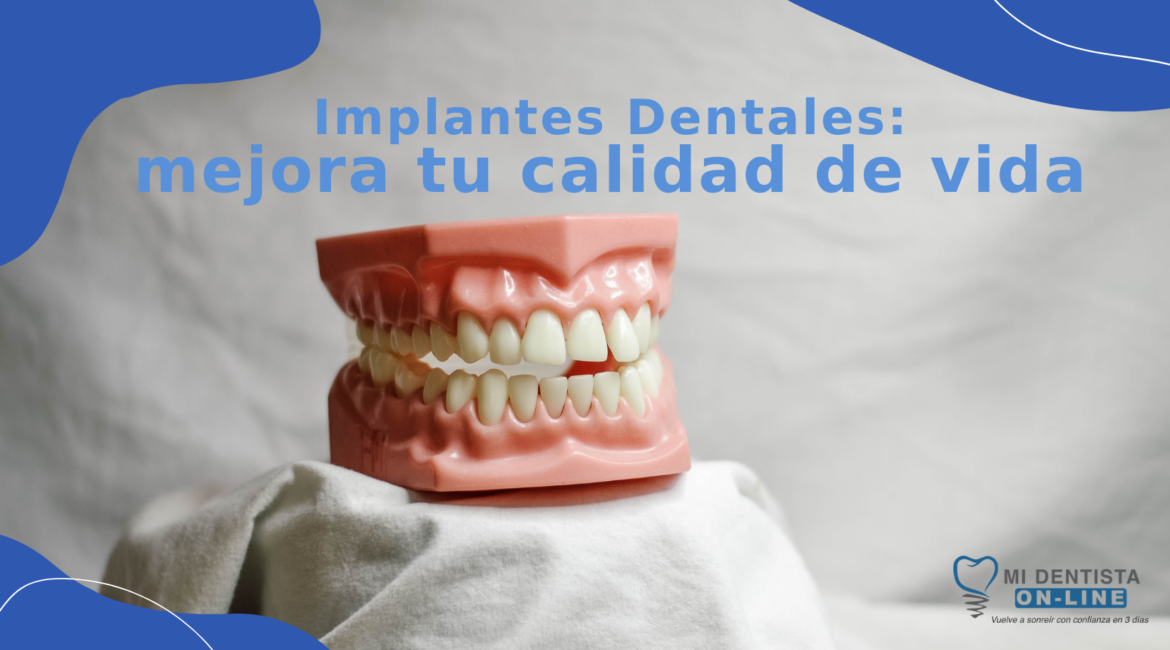 Implantes dentales mejoran la calidad de vida de un paciente