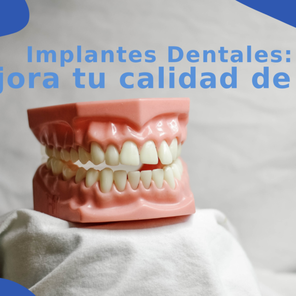 Implantes dentales mejoran la calidad de vida de un paciente