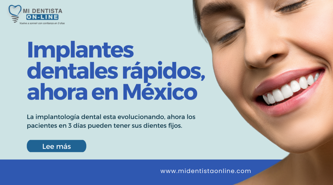 Implantes dentales ahora en cdmx, la implantes dentales rapidos