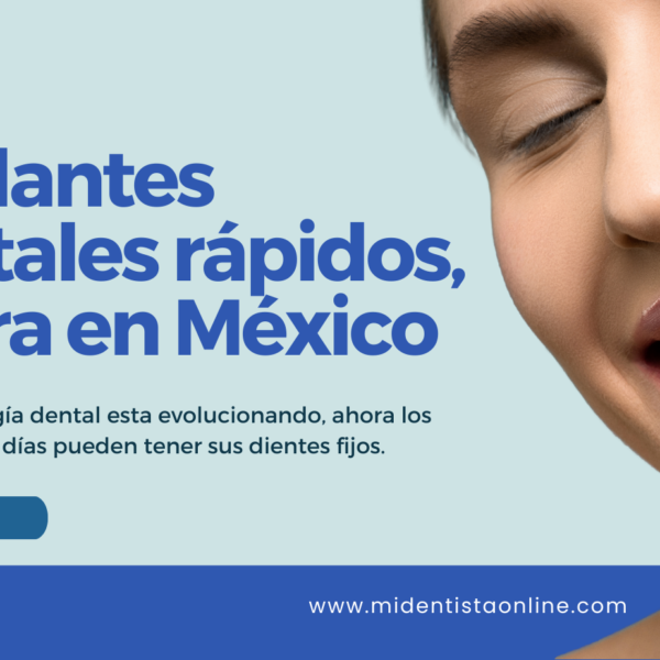 Implantes dentales ahora en cdmx, la implantes dentales rapidos