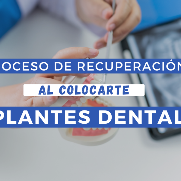 Cuidados post operatorios al colocarte implantes dentales