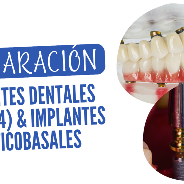 diferencia entre Implantes all on 4 y corticobasales