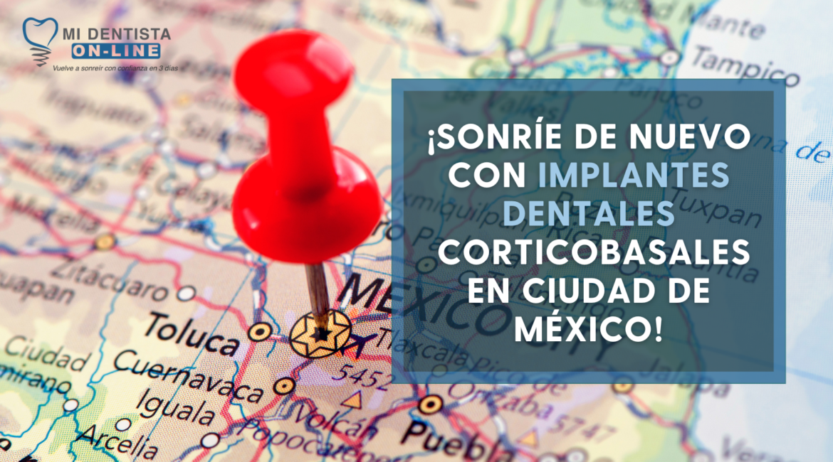 En nuestra clínica contamos con uno de los mejores implantologos corticobasales en Ciudad de México