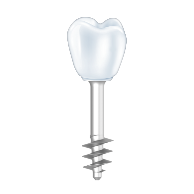 implantes dentales monofasicos méxico