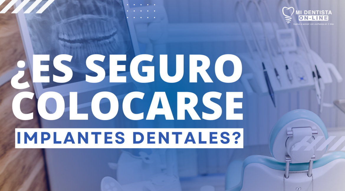 Es seguro colocarse implantes dentales