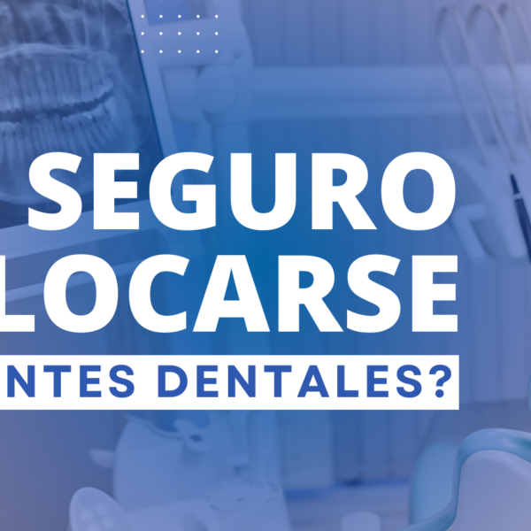 Es seguro colocarse implantes dentales