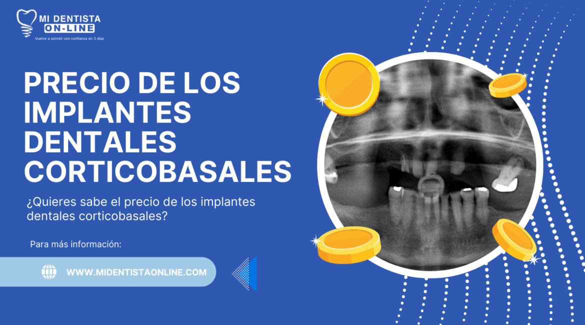 Precio de los Implantes Corticobasales en México y en el Extranjero