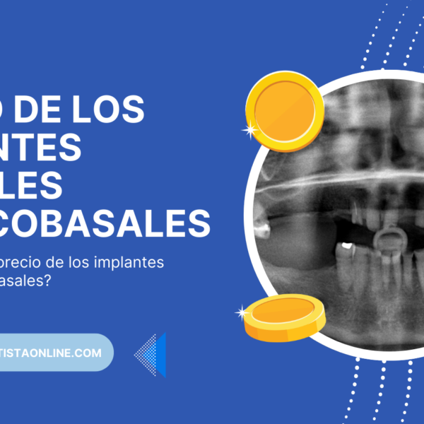 Precio de los Implantes Corticobasales en México y en el Extranjero