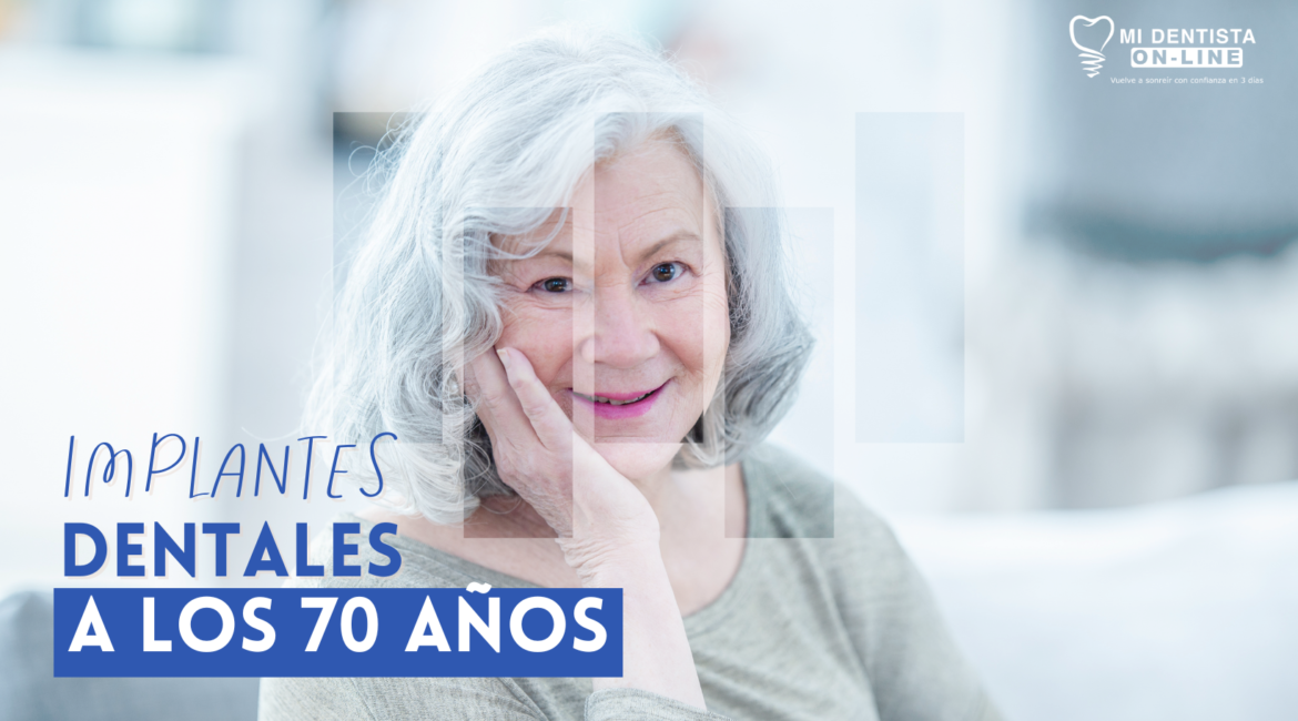 IMPLANTES DENTALES A LOS 70