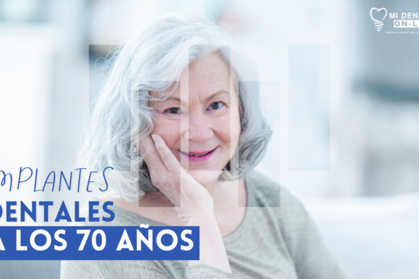 IMPLANTES DENTALES A LOS 70