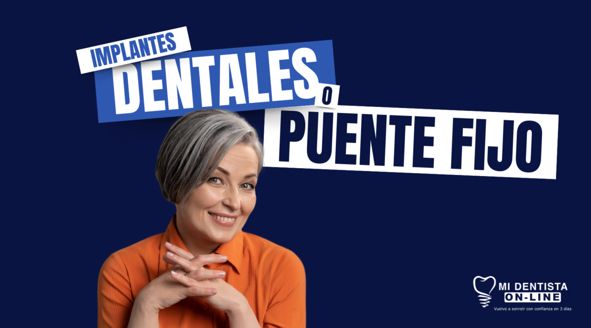 Implantes dentales o puente dental