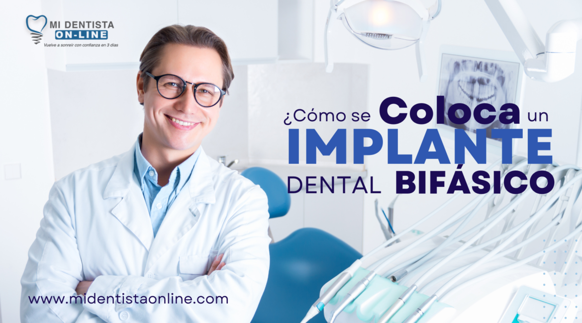 Implantes dentales en CDMX, Clínica Dental