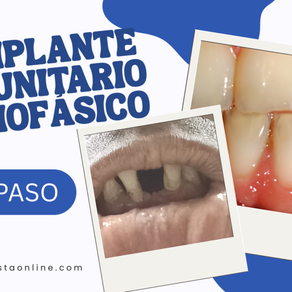 implante dental unitario en un solo paso