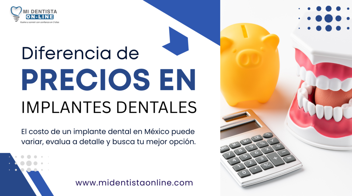 Precio implante barato monofásico