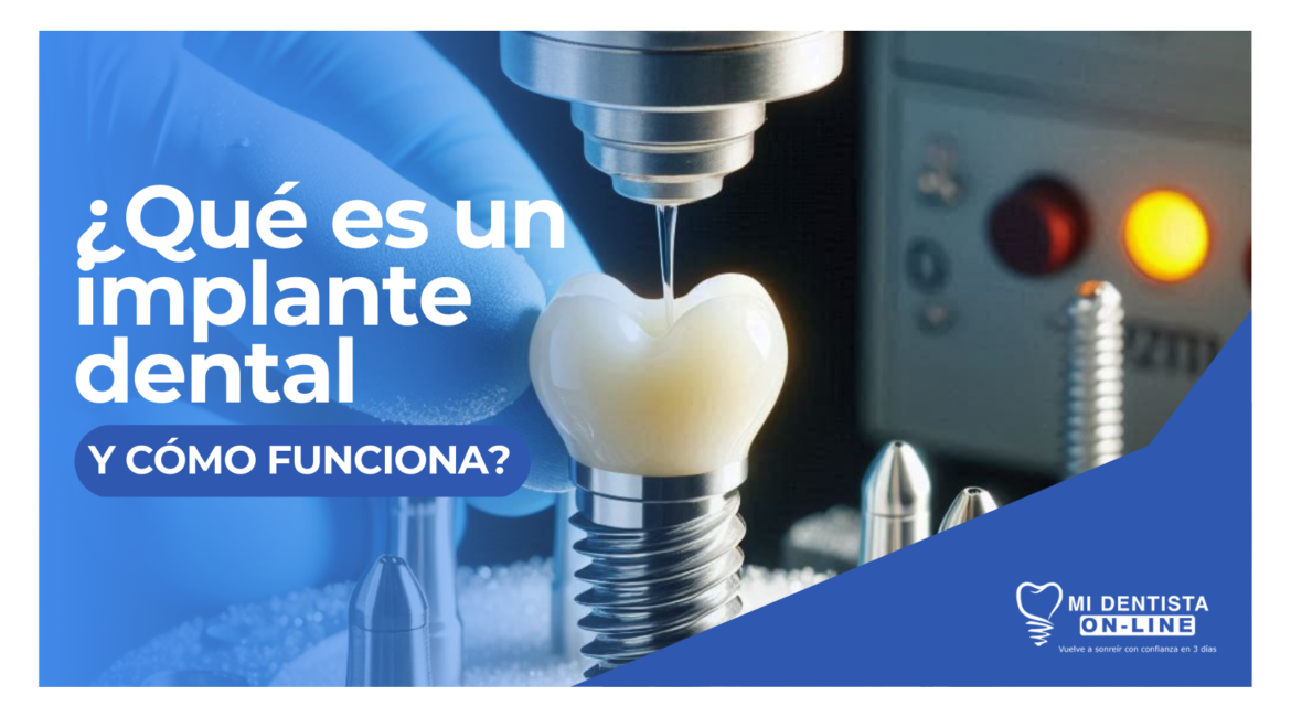 ¿Qué es un implante dental y cómo funciona?