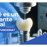 ¿Qué es un Implante Dental?
