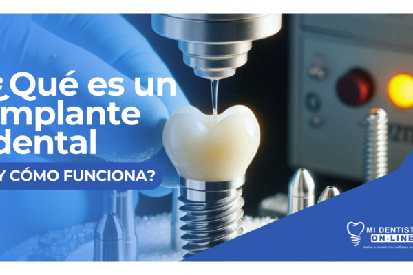¿Qué es un implante dental y cómo funciona?