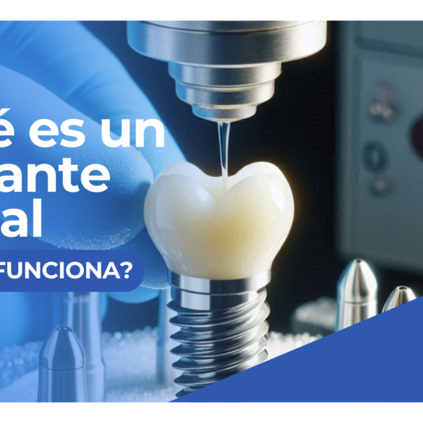 ¿Qué es un implante dental y cómo funciona?