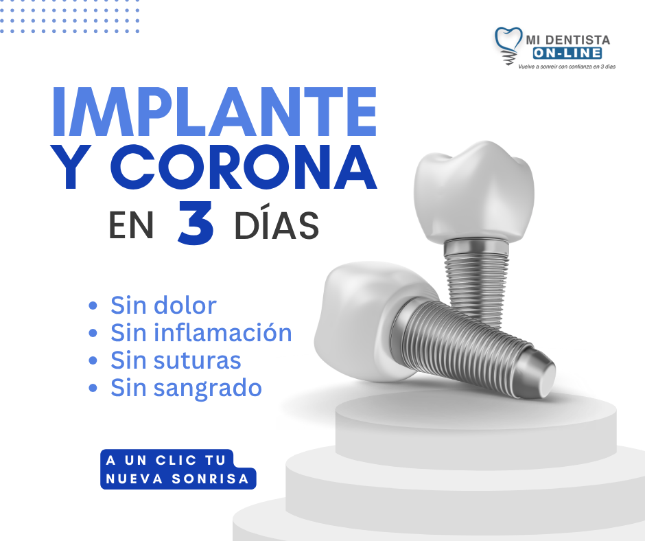 Implante monofásico cdmx