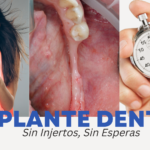  Implantología Monofásica en México: Sin Injertos, Sin Esperas