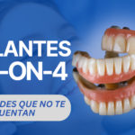 Implantes All-on-4: ¿Demasiado Buenos para Ser Verdad? 5 Verdades que No Te Cuentan