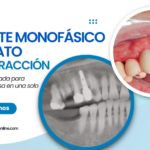Implante Monofásico Inmediato Postextracción