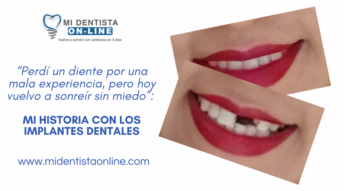 Perdí un diente y lo recupere con Implantes Monofásicos