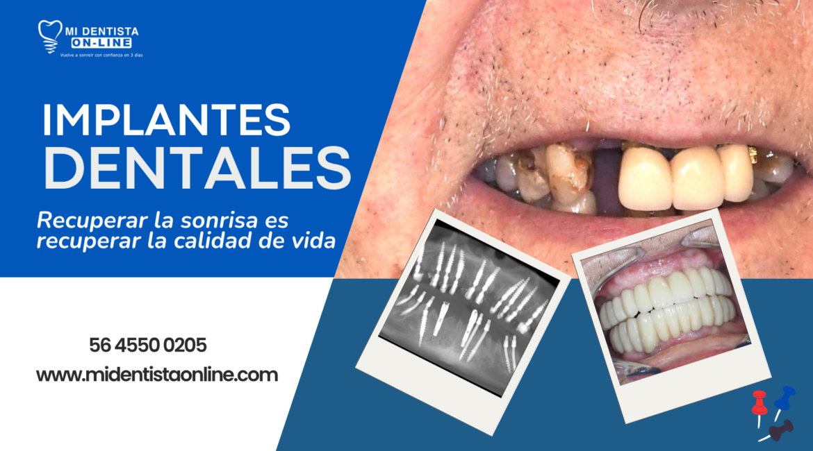 Especialista en implantología Monofásica CDMX