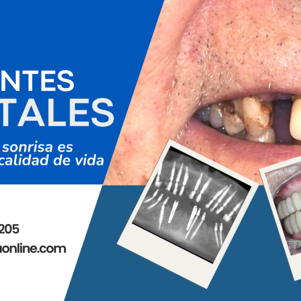 Especialista en implantología Monofásica CDMX